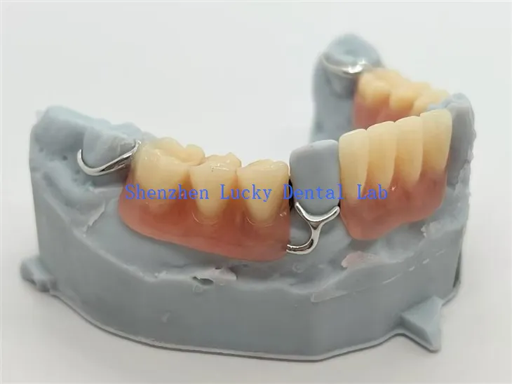 3D-tulostuksen akryyliosat T-tangolla