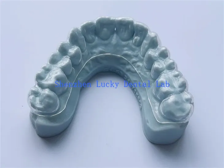 3D -tulostusvalkaisuaineen hammaslaboratorio