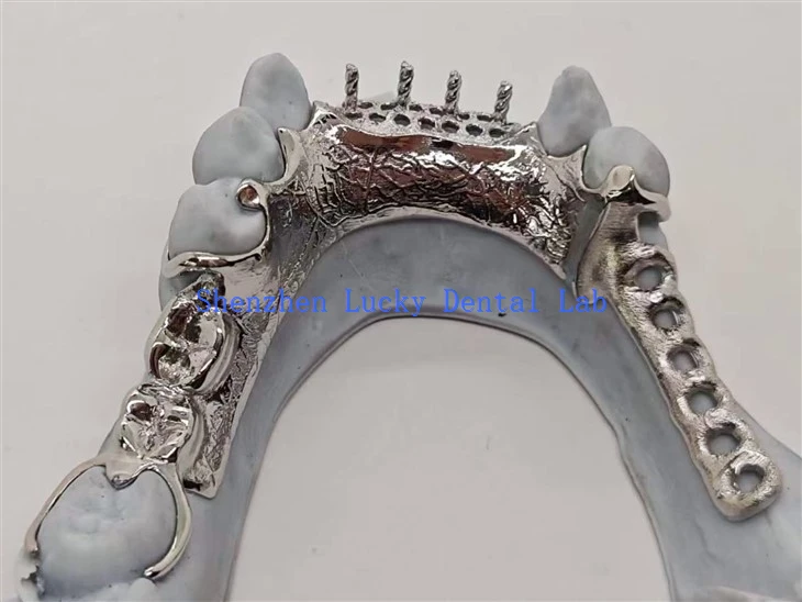 3D-tulostuksen metallikehys metalliseoshammastaustalla