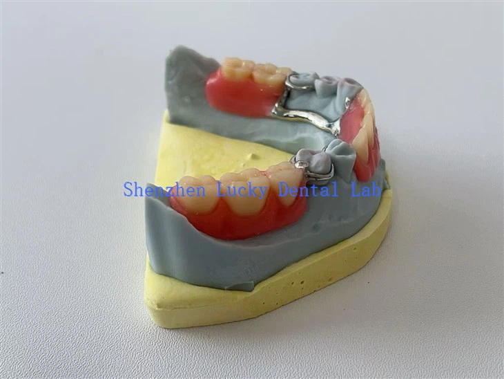 3D -tulostus osittainen akryylihammashammasproteesi kokeile hammaslaboratoriossa