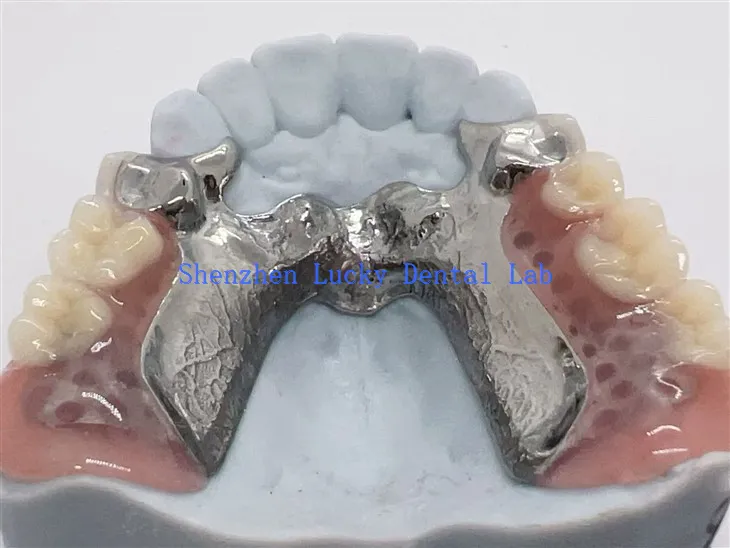 3D Print Titanium Alloy Framework