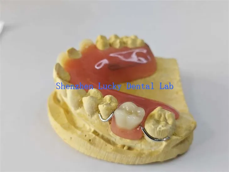 Mukava langan taivutus lukko akryylihammasproteesia hammaslaboratorio