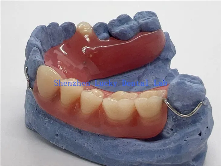 Mukava osittainen akryylihammasproteesi langan lukkoon