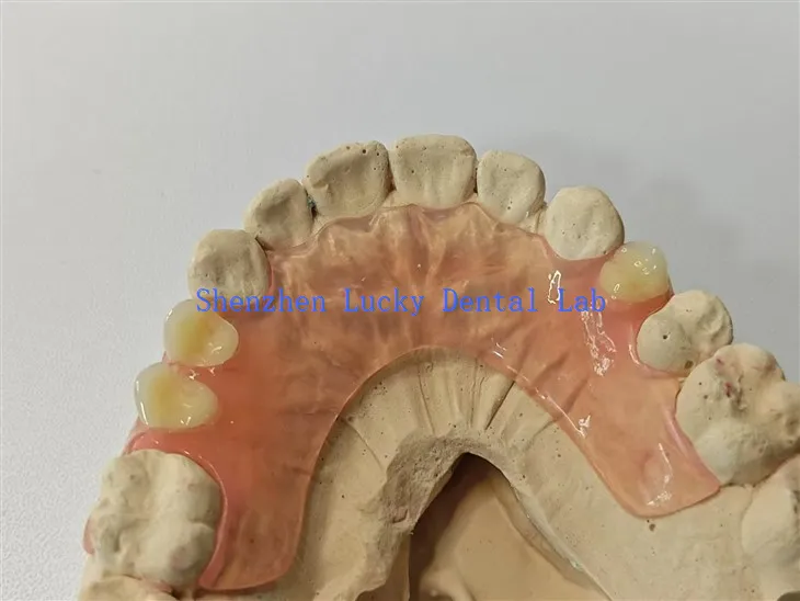 Mukava joustava hammasproteesi hammaslaboratorio