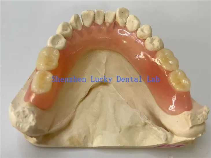 Osittainen joustava hammasproteesien hammaslaboratorio