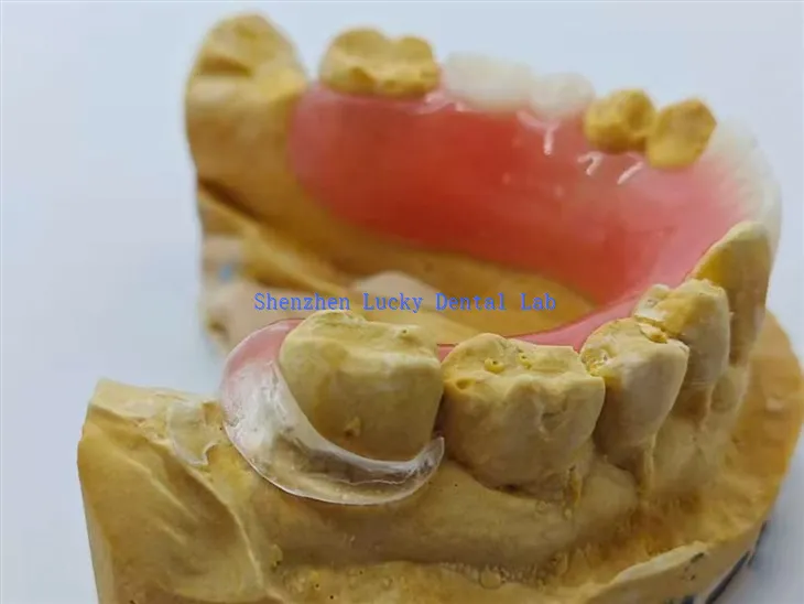 Akryylihammasproteesi selkeällä lukolla