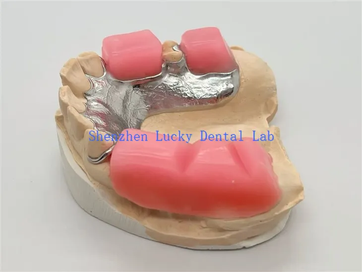 Metallikehys, jossa on puremislohko